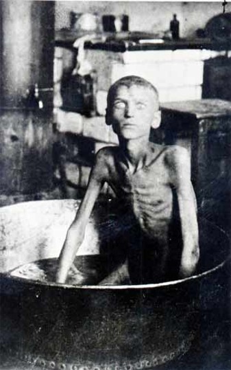 Image - A starving child during the Famine of 1921-22.