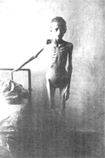 Image -- A victim of the Famine-Genocide of 1932-3.