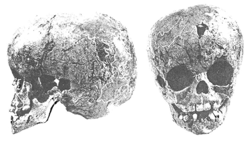Image - Starosilia archeological site: a skull of buried Cro-Magnon child with some Neanderthal features.
