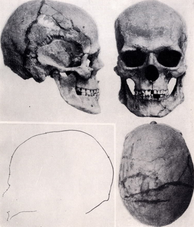 Image - A skull excavated at the Vovnihy burial site.