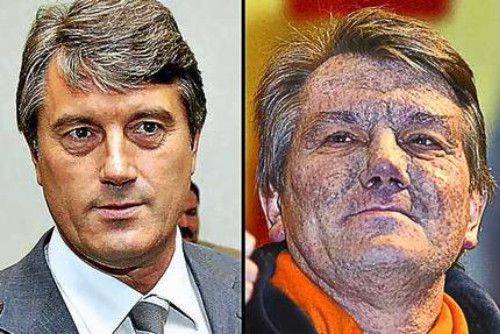 Image - Viktor Yushchenko (before and after his poisoning).